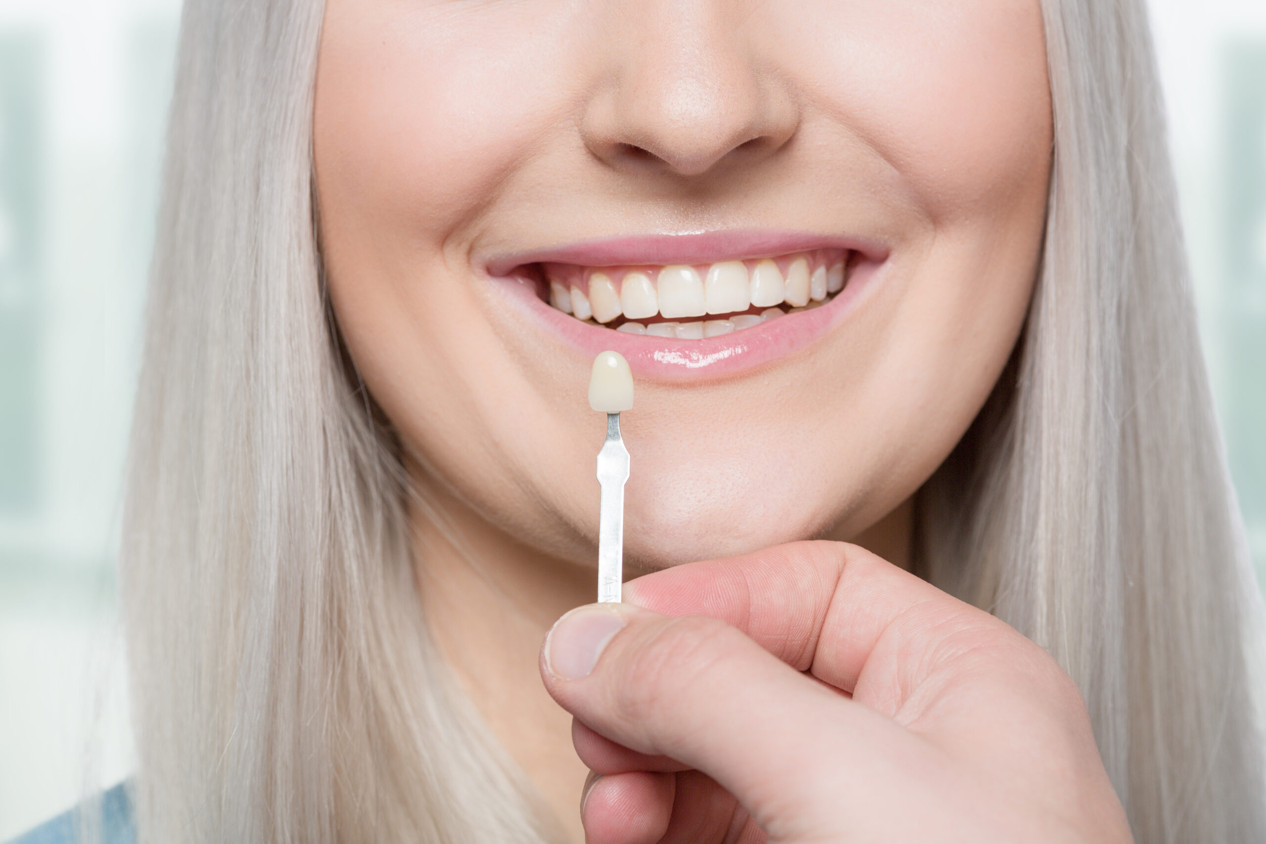Veneers London - The London Centre for Cosmetic Dentistry